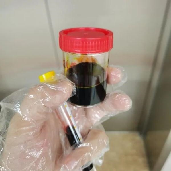 急性肝衰竭！兩兄弟誤吃這種菌 專家提醒